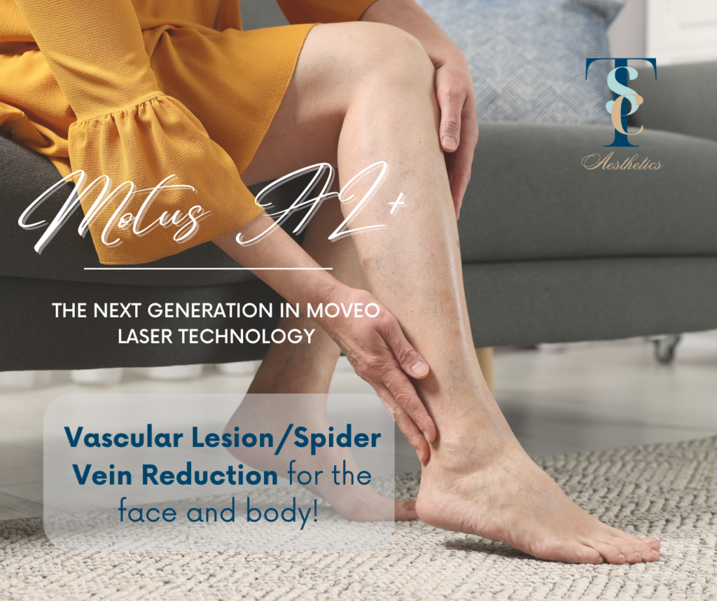 Vascular Lesion/ Spider vein Reduction for the face and body - TSC Aesthetics